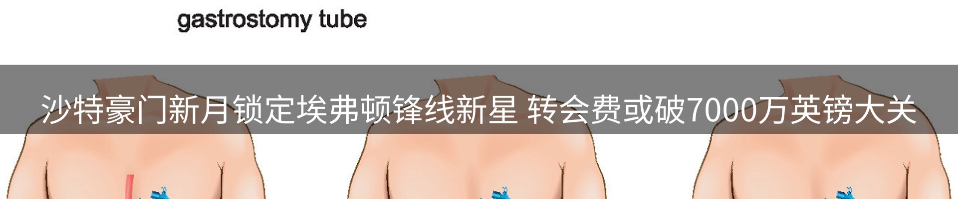 平台资讯